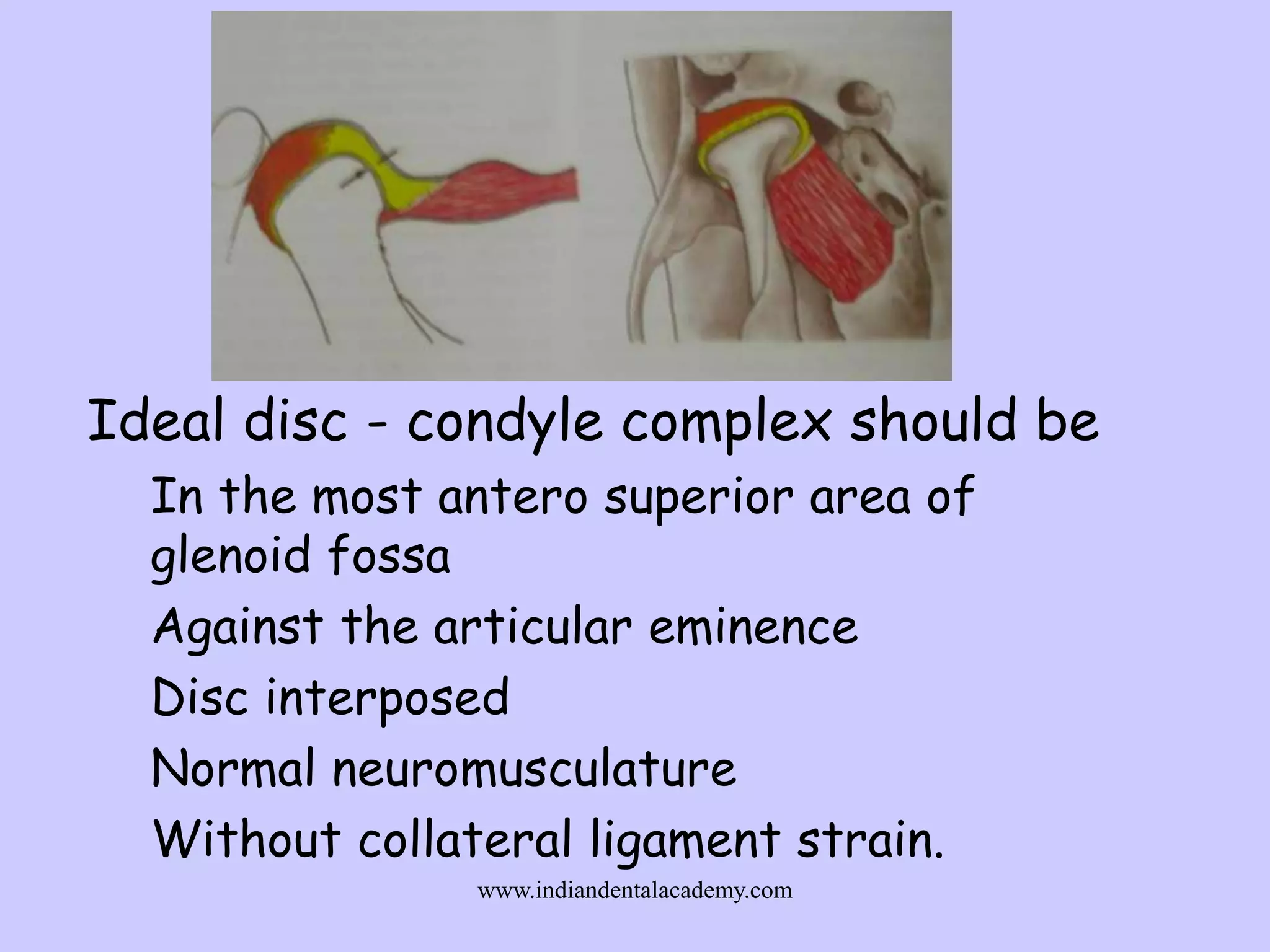 Ideal disc - condyle complex should be
In the most antero superior area of
glenoid fossa
Against the articular eminence
Disc interposed
Normal neuromusculature
Without collateral ligament strain.
www.indiandentalacademy.com

 