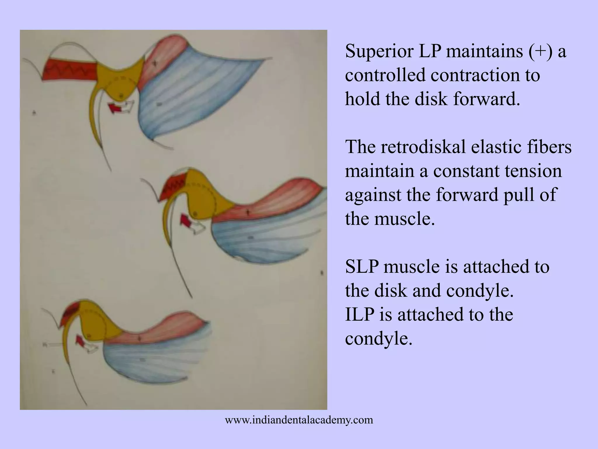 Superior LP maintains (+) a
controlled contraction to
hold the disk forward.
The retrodiskal elastic fibers
maintain a constant tension
against the forward pull of
the muscle.
SLP muscle is attached to
the disk and condyle.
ILP is attached to the
condyle.

www.indiandentalacademy.com

 