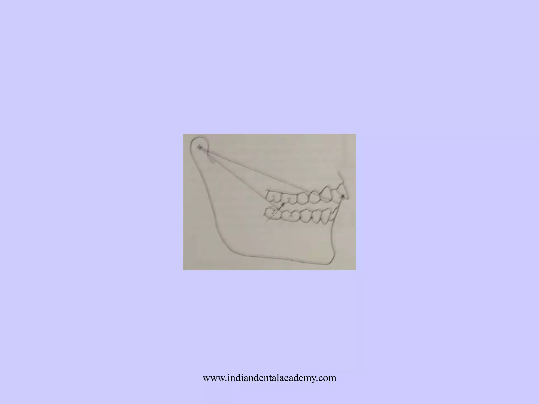 www.indiandentalacademy.com

 