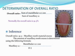 DETERMINATION OF OVERALL RATIO
Sum of mandibular 12 x 100Overall ratio=
Sum of maxillary 12
 Inference
Overall ratio< 91.3 – Maxillary tooth material excess
The amount of maxillary tooth excess is determined
using the following formula:
Maxillary 12 -
Mandibular 12 x 100
91.3
Normally the overall ratio is 91.3%
 