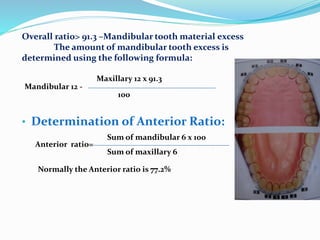 Overall ratio> 91.3 –Mandibular tooth material excess
The amount of mandibular tooth excess is
determined using the following formula:
Mandibular 12 -
Maxillary 12 x 91.3
100
• Determination of Anterior Ratio:
Sum of mandibular 6 x 100
Anterior ratio=
Sum of maxillary 6
Normally the Anterior ratio is 77.2%
 