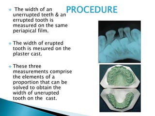  The width of an
unerrupted teeth & an
errupted tooth is
measured on the same
periapical film.
 The width of erupted
tooth is mesured on the
plaster cast.
 These three
measurements comprise
the elements of a
proportion that can be
solved to obtain the
width of unerupted
tooth on the cast.
 