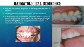 Spcl Orthodontic treatment for spcl children ruq.pptx