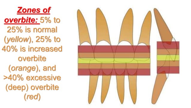 Orthodontic treatment of deep bite part 1 | PPTX | Oral care | Personal ...