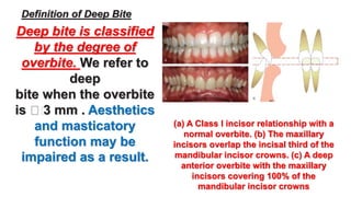 Orthodontic treatment of deep bite part 1 | PPTX