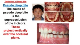 Orthodontic treatment of deep bite part 1 | PPTX