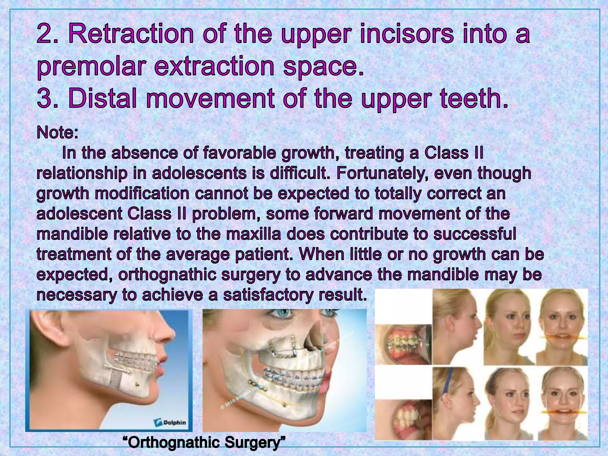 Orthodontic treatment planning