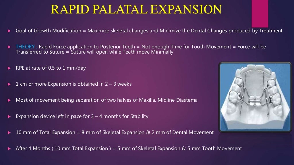 Orthodontic treatment planning