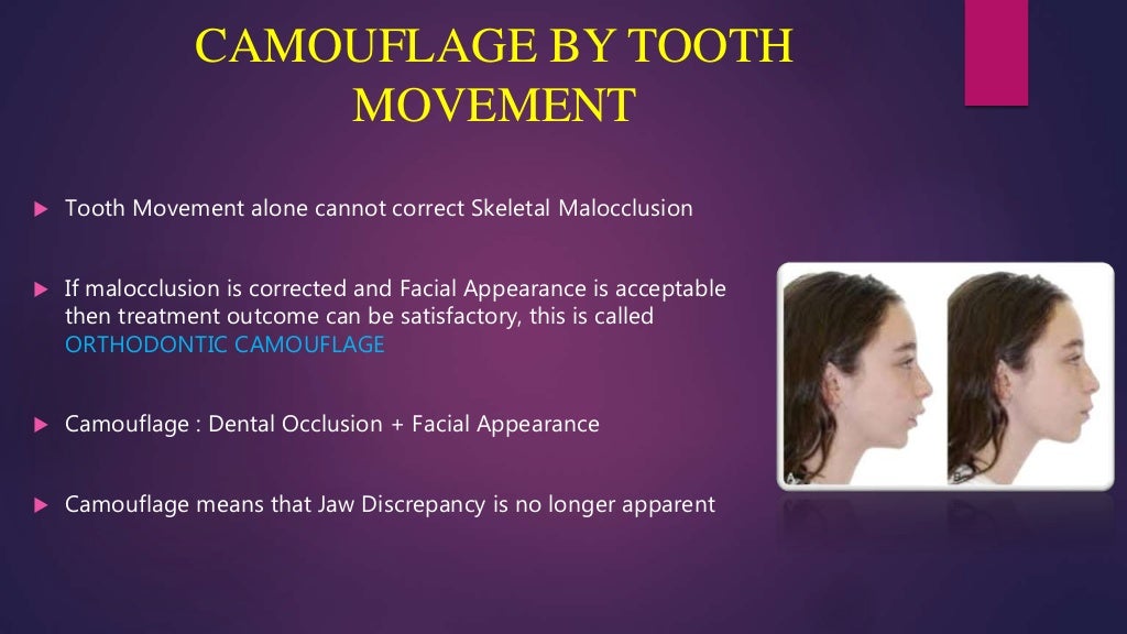 Orthodontic treatment planning