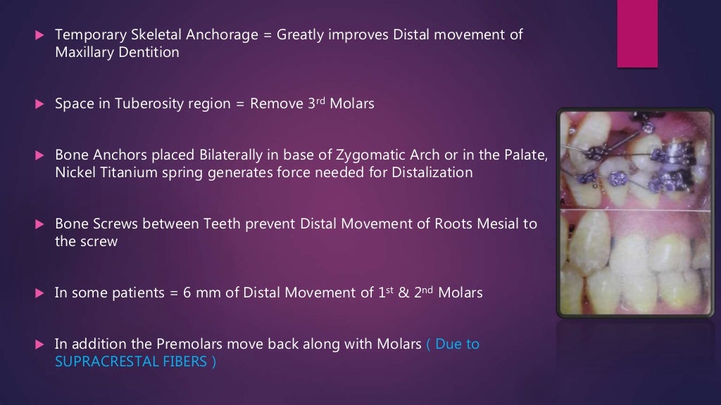 Orthodontic treatment planning