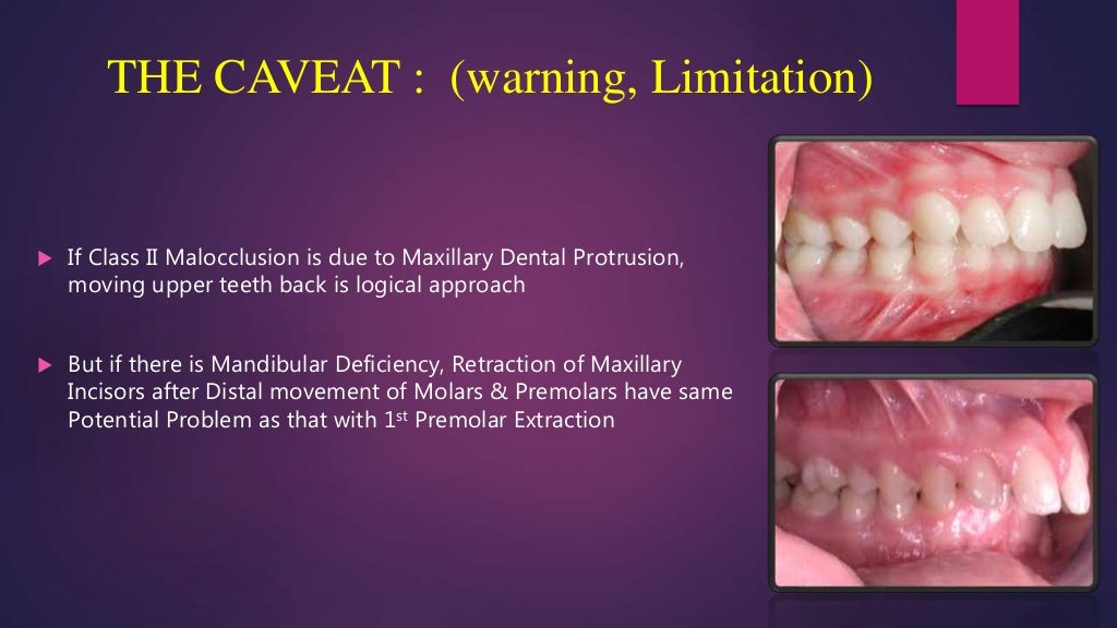 Orthodontic treatment planning