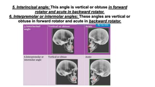 Orthodontic vertical discrepancies 1- LONG FACE | PPTX