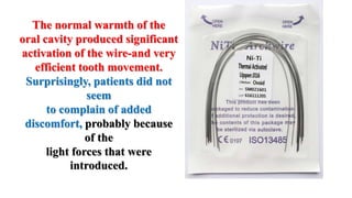 MBT wire sequence during orthodontic alignment and leveling | PPTX