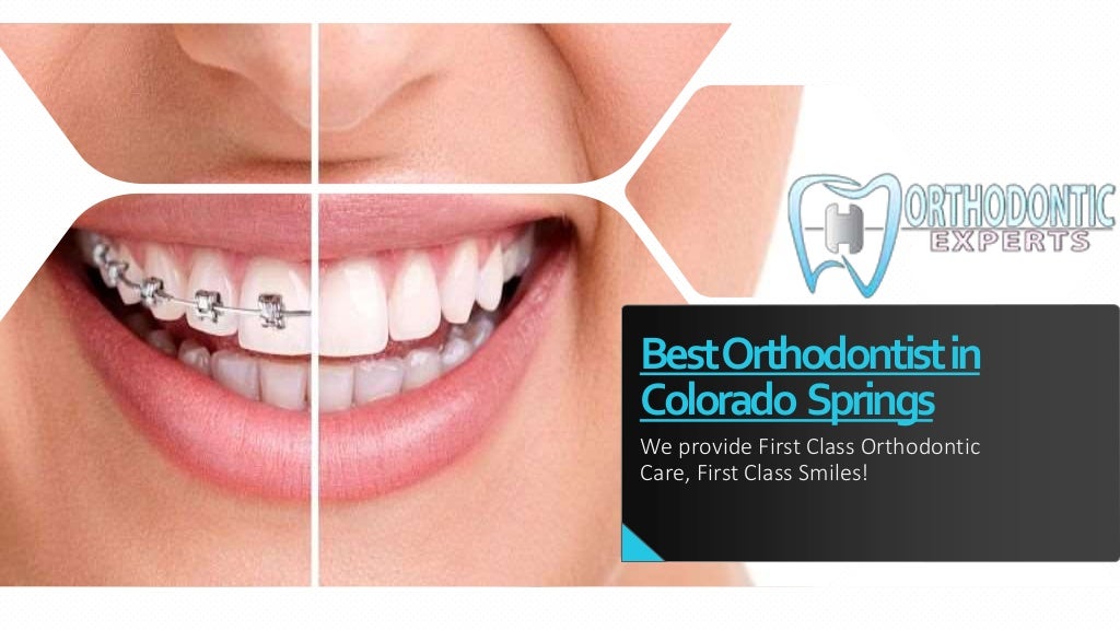 Invisalign in Colorado Springs Orthodontic Treatments Colorado Springs