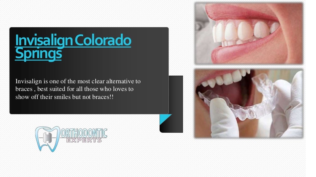 Invisalign in Colorado Springs Orthodontic Treatments Colorado Spri…