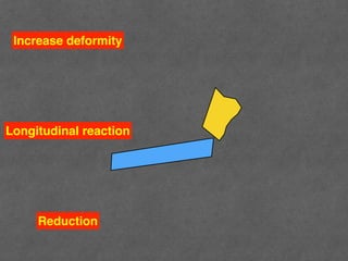 Common Hand Injury | PDF