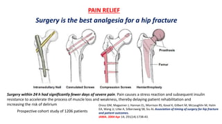 PAIN RELIEF
Orosz GM, Magaziner J, Hannan EL, Morrison RS, Koval K, Gilbert M, McLaughlin M, Halm
EA, Wang JJ, Litke A, Silberzweig SB, Siu AL Association of timing of surgery for hip fracture
and patient outcomes.
JAMA. 2004 Apr 14; 291(14):1738-43.
Surgery within 24 h had significantly fewer days of severe pain. Pain causes a stress reaction and subsequent insulin
resistance to accelerate the process of muscle loss and weakness, thereby delaying patient rehabilitation and
increasing the risk of delirium
Prospective cohort study of 1206 patients
Surgery is the best analgesia for a hip fracture
 
