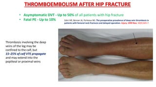 • Asymptomatic DVT - Up to 50% of all patients with hip fracture
• Fatal PE - Up to 10%
THROMBOEMBOLISM AFTER HIP FRACTURE
Zahn HR, Skinner JA, Porteous MJ. The preoperative prevalence of deep vein thrombosis in
patients with femoral neck fractures and delayed operation. Injury. 1999 Nov; 30(9):605-7.
Thrombosis involving the deep
veins of the leg may be
confined to the calf, but
15–25% of calf VTE propagate
and may extend into the
popliteal or proximal veins
 