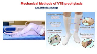 Anti Embolic Stockings
Mechanical Methods of VTE prophylaxis
 