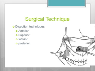 Orthognathic surgery