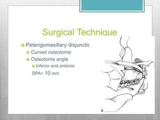 Orthognathic surgery