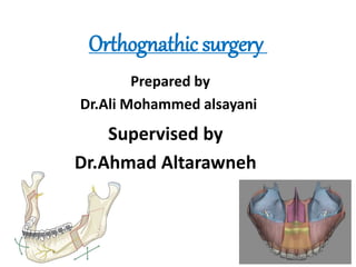 Orthognathic surgery
Supervised by
Dr.Ahmad Altarawneh
Prepared by
Dr.Ali Mohammed alsayani
 