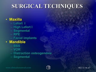 SURGICAL TECHNIQUES   Maxilla  Lefort  I High Lefort I Segmental  RPE Facial implants Mandible  BSS VOR Distraction osteogenesis Segmental  