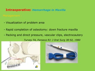 Management :
- Visualization of problem area
- Rapid completion of osteotomy: down fracture maxilla
- Packing and direct pressure, vascular clips, electrocautery
Turvey TA, Fonseca RJ: J Oral Surg 38:92, 1980
Intraoperative: Hemorrhage in Maxilla
 