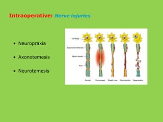 • Neuropraxia
• Axonotemesis
• Neurotemesis
Intraoperative: Nerve injuries
 