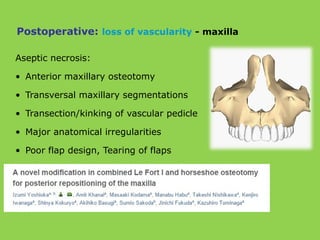 Aseptic necrosis:
• Anterior maxillary osteotomy
• Transversal maxillary segmentations
• Transection/kinking of vascular pedicle
• Major anatomical irregularities
• Poor flap design, Tearing of flaps
Postoperative: loss of vascularity - maxilla
 