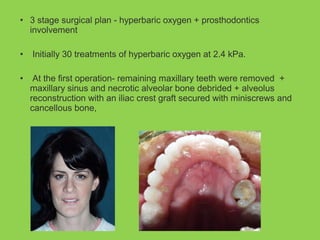 • 3 stage surgical plan - hyperbaric oxygen + prosthodontics
involvement
• Initially 30 treatments of hyperbaric oxygen at 2.4 kPa.
• At the first operation- remaining maxillary teeth were removed +
maxillary sinus and necrotic alveolar bone debrided + alveolus
reconstruction with an iliac crest graft secured with miniscrews and
cancellous bone,
 