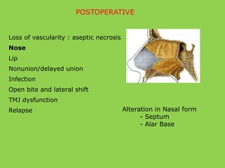 POSTOPERATIVE
Alteration in Nasal form
- Septum
- Alar Base
Loss of vascularity : aseptic necrosis
Nose
Lip
Nonunion/delayed union
Infection
Open bite and lateral shift
TMJ dysfunction
Relapse
 