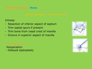 Intraop
- Resection of inferior aspect of septum
- Trim septal spurs if present
- Trim bone from nasal crest of maxilla
- Groove in superior aspect of maxilla
Septal deviation - How to avoid?
Management
-Reoperation
- Delayed septoplasty
Postoperative: Nose
 