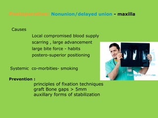 Causes
Local compromised blood supply
scarring , large advancement
large bite force - habits
postero-superior positioning
Systemic co-morbities- smoking
Prevention :
principles of fixation techniques
graft Bone gaps > 5mm
auxillary forms of stabilization
Postoperative: Nonunion/delayed union - maxilla
 