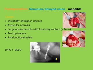 Causes :
• Instability of fixation devices
• Avascular necrosis
• Large advancements with less bony contact (>7mm)
• Post op trauma
• Parafunctional habits
IVRO > BSSO
Postoperative: Nonunion/delayed union - mandible
 