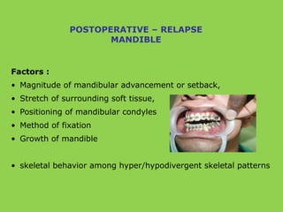 Factors :
• Magnitude of mandibular advancement or setback,
• Stretch of surrounding soft tissue,
• Positioning of mandibular condyles
• Method of fixation
• Growth of mandible
• skeletal behavior among hyper/hypodivergent skeletal patterns
POSTOPERATIVE – RELAPSE
MANDIBLE
 