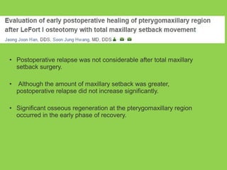 • Postoperative relapse was not considerable after total maxillary
setback surgery.
• Although the amount of maxillary setback was greater,
postoperative relapse did not increase significantly.
• Significant osseous regeneration at the pterygomaxillary region
occurred in the early phase of recovery.
 