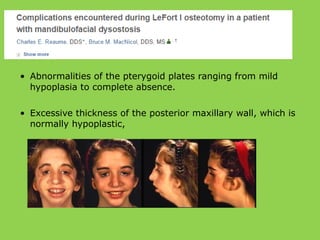 • Abnormalities of the pterygoid plates ranging from mild
hypoplasia to complete absence.
• Excessive thickness of the posterior maxillary wall, which is
normally hypoplastic,
 