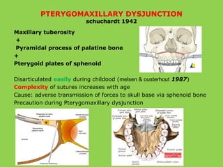 PTERYGOMAXILLARY DYSJUNCTION
schuchardt 1942
Maxillary tuberosity
+
Pyramidal process of palatine bone
+
Pterygoid plates of sphenoid
Disarticulated easily during childood (melsen & ousterhout 1987)
Complexity of sutures increases with age
Cause: adverse transmission of forces to skull base via sphenoid bone
Precaution during Pterygomaxillary dysjunction
 