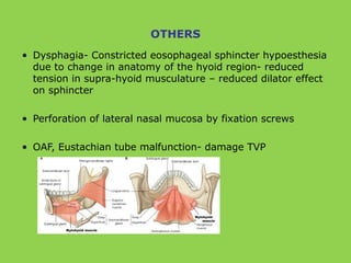 OTHERS
• Dysphagia- Constricted eosophageal sphincter hypoesthesia
due to change in anatomy of the hyoid region- reduced
tension in supra-hyoid musculature – reduced dilator effect
on sphincter
• Perforation of lateral nasal mucosa by fixation screws
• OAF, Eustachian tube malfunction- damage TVP
 