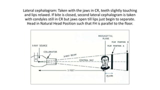 Orthognathic Surgery: diagnosis | PPTX