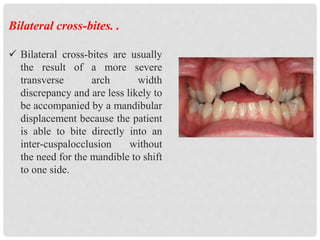 dentofacial assessment for orthognathic surgery by ALAA EL KASABY | PPTX