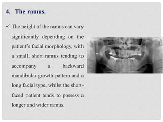 dentofacial-assessment-for-orthognathic-surgery-by-alaa-el-kasaby-pptx