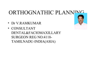 ORTHOGNATHIC PLANNING 
• Dr V.RAMKUMAR 
• CONSULTANT 
DENTAL&FACIOMAXILLARY 
SURGEON REG NO:4118- 
TAMILNADU-INDIA(ASIA) 
 