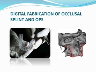 Obs Splint Orthognathic Positioning System | PPTX
