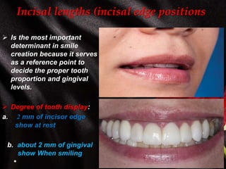 Incisal lengths (incisal edge positions
 Is the most important
determinant in smile
creation because it serves
as a reference point to
decide the proper tooth
proportion and gingival
levels.
 Degree of tooth display:
a. 2 mm of incisor edge
show at rest
b. about 2 mm of gingival
show When smiling
 