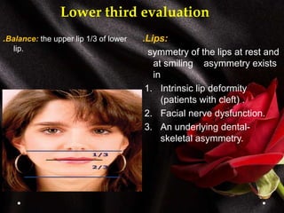 Lower third evaluation
.Balance: the upper lip 1/3 of lower
lip.
.Lips:
symmetry of the lips at rest and
at smiling asymmetry exists
in
1. Intrinsic lip deformity
(patients with cleft) .
2. Facial nerve dysfunction.
3. An underlying dental-
skeletal asymmetry.
 