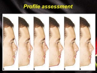 Profile assessment
 