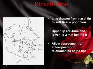 Ricketts line
• Line drawen from nasal tip
to soft tissue pogonion
• Upper lip are 4mm and
lower lip 2 mm behind it
• Allow assessment of
anteroposterior
relationships of the lips
 