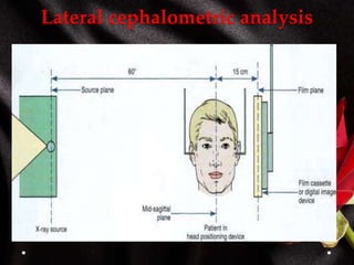 Lateral cephalometric analysis
 